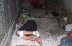 Алиса из Кызылорды, едва не умершая от загнивающих ожогов, рассказала свою историю