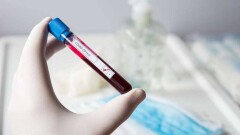 За прошедшие сутки в Казахстане коронавирус подтвердили ещё у 356 человек