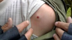 В ДВД Костанайской области выясняют характер ранений участвовавшего в драке подростка