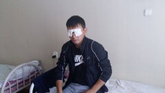 Житель Карагандинской области, которому прострелили оба глаза, останется слепым