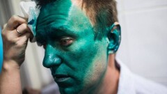 Навальный рискует ослепнуть на один глаз 