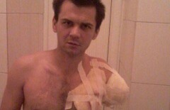 Лишившийся руки на работе алматинец требует компенсацию 