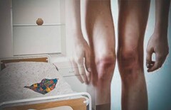 Подопечный психдиспансера в Акмолинской области похудел на 20 кг от недоедания