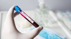 За прошедшие сутки в Казахстане выявили 314 пациентов с Covid-19 и 630 бессимптомных носителей вируса