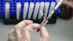 Число заболевших гепатитом в Карагандинской области продолжает расти