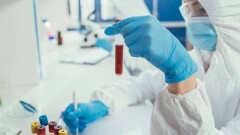 Число заражённых коронавирусом в Казахстане превысило 130 000 человек 