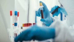 Экспресс-тесты выявили антитела к коронавирусу у 64 человек