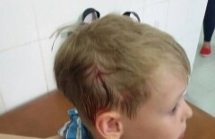 В Актау 5-летний ребенок, сбитый велосипедистом, попал в больницу с переломом костей черепа