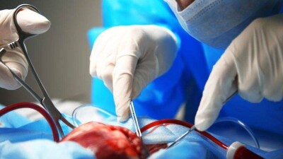 Қазақстандықтардың органдары шетелдіктерге берілмейді. Үш мыңнан астам адам донорға зәру