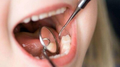 Внеплановую проверку инициировал Минздрав после смерти ребёнка в стоматологии