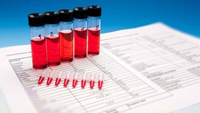 В ТШО проведут расследование фактов подделки ПЦР-тестов работников