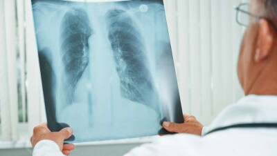 В Алматы врачи в день госпитализируют до 220 пациентов с пневмонией