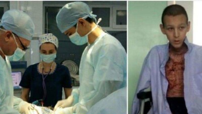 Акмолинские врачи полгода выхаживали подростка, тело которого обгорело на 50%