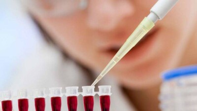 Эксперты не смогли определить тип гепатита у девочки, скончавшейся в ВКО