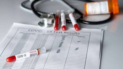 За сутки в Казахстане выявили 110 случаев заражения Covid-19, наибольший прирост в Нур-Султане