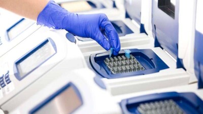 СК-Фармация отказалась принимать часть ПЦР-тестов по договору с отечественным поставщиком из-за ненадобности