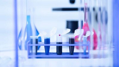 За сутки в Казахстане выявили 1414 случаев заражения Covid-19