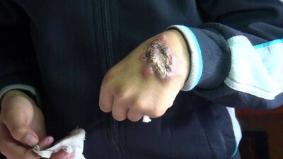 Страшными язвами покрылись сельчане в ЮКО
