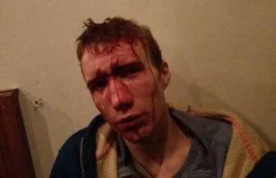 Полицейские Жезказгана беспричинно избили инвалида и выставили его виноватым – мать пострадавшего