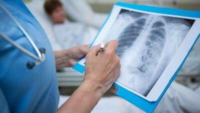 За сутки в Казахстане умер 21 пациент с подтверждённым диагнозом Covid-19 и 10 больных пневмонией