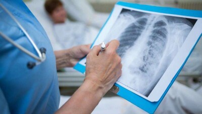 В Казахстане за сутки выявили 27 больных коронавирусной пневмонией