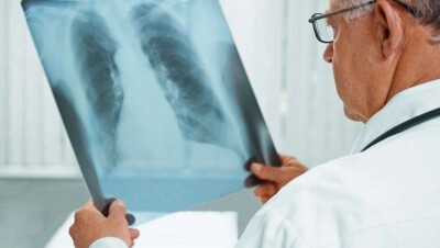 За сутки в Казахстане скончались 29 пациентов с Covid-19 и 17 больных с пневмонией