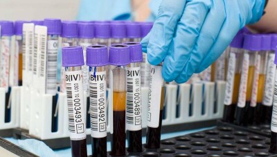 Главный санитарный врач РК: До конца мая прогнозируем регистрацию 4000 случаев заражения Covid-19