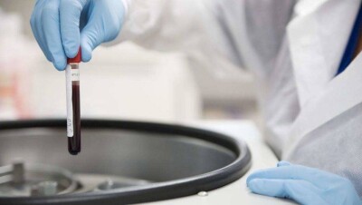 СК-Фармация: Перебоев с поставками лекарств для пациентов с гемофилией не было