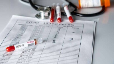 За сутки в Казахстане выявили 173 случая заражения Covid-19, 585 человек выздоровели