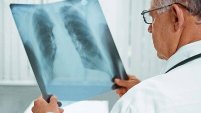 В Казахстане пациентов с пневмонией, которую вызвал Covid-19, будут лечить на дому