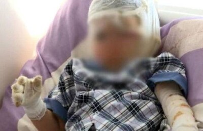 Коллектор поджёг двухлетнего ребёнка должников в России