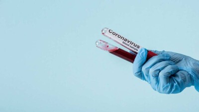 За сутки в Казахстане выявили 822 случая заражения Covid-19, 412 человек выздоровели 