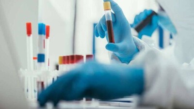 В Казахстане за сутки выявили 712 случаев заражения Covid-19 и 33 заболевших коронавирусной пневмонией