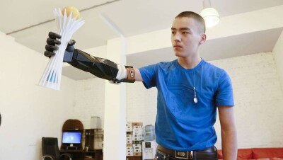 "Ақылды" протез семейлік жасөспірімнің өмірін түбегейлі өзгертті