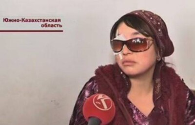 В Кентау собаколовы расстреляли женщину, лишив её глаза