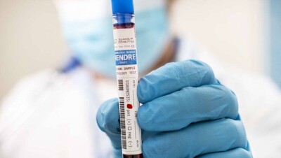 В Казахстане за сутки выявили 723 случая заражения Covid-19, 138 человек выздоровели