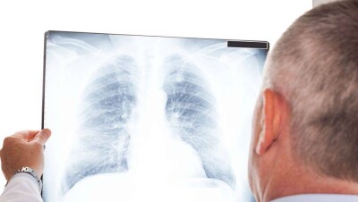 В Казахстане за сутки выявили 543 больных с коронавирусной пневмонией 