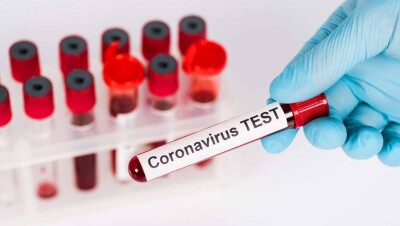 За сутки в Казахстане выявили 230 случаев заражения Covid-19, 1377 человек выздоровели