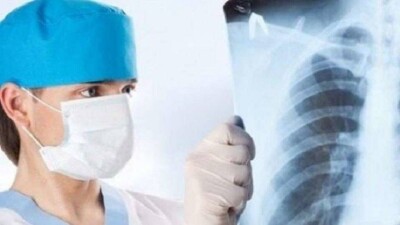 Бала-бақша меңгерушісінің туберкулездің жұқпалы түрімен ауыратындығы анықталды. Жаңалықтарға шолу 