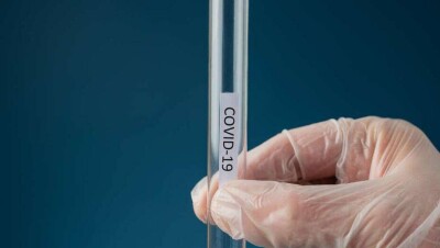 В Казахстане за сутки выявили 568 случаев заражения Covid-19