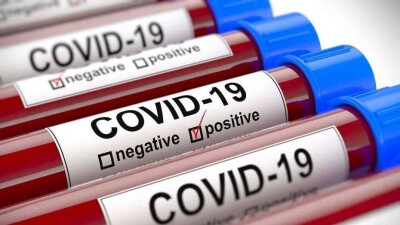 В мире число заражённых Covid-19 достигло 77 млн человек, умерших – почти 1,7 млн