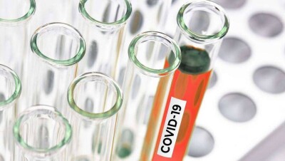 За сутки в Казахстане выявили 1472 случая заражения Covid-19 