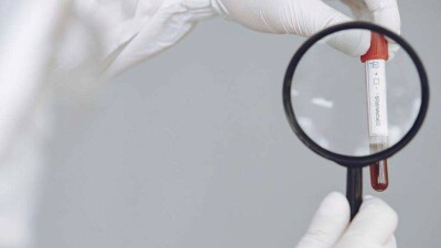 24 қыркүйекте Қазақстанда коронавирус жұқтырған 61 адам тіркелді