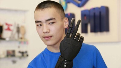 Электронную руку из игры Deus Ex: Human Revolution установили подростку из ВКО