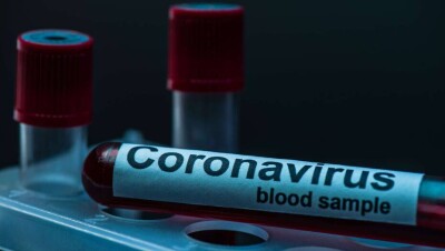 В Казахстане за сутки выявили 794 случая заражения Covid-19