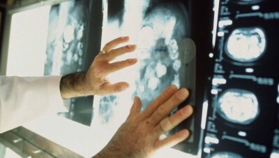 В Армении решили проводить онкологические операции бесплатно