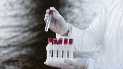 Мор рыбы в резервате "Акжайык": содержание железа в воде почти в два раза превышало норму