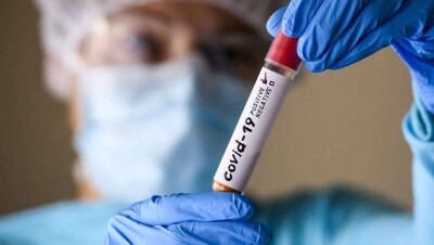 В ВОЗ считают, что Covid-19 могли заразиться 10% населения планеты