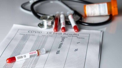 За сутки в Казахстане выявили 72 случая заражения Covid-19, 188 человек выздоровели