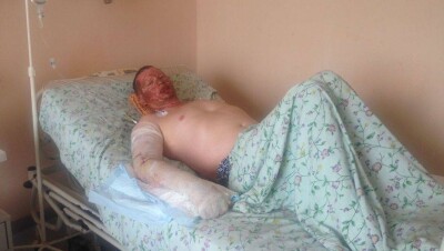 Самоподжог из-за сноса гаража в Астане: акимат обозначил свою позицию